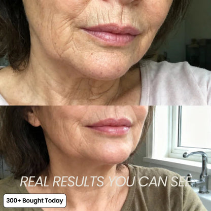 🔥LAST DAY 60% OFF Zrevyn Korean Pink Collagen Volume Multi Balm
