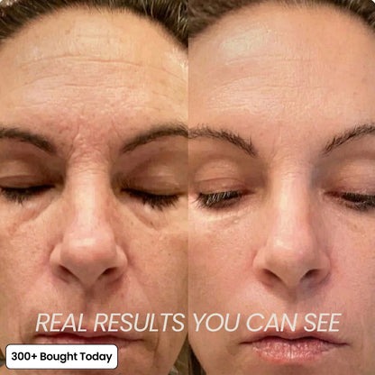🔥LAST DAY 60% OFF Zrevyn Korean Pink Collagen Volume Multi Balm