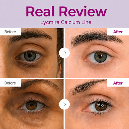 Korean Calcium Dark Spot Eye Cream