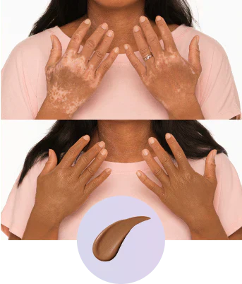 Body Coverage Perfector SPF 30 – Body Makeup for the Face, Arms & Body